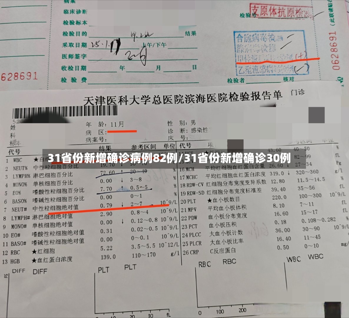 31省份新增确诊病例82例/31省份新增确诊30例