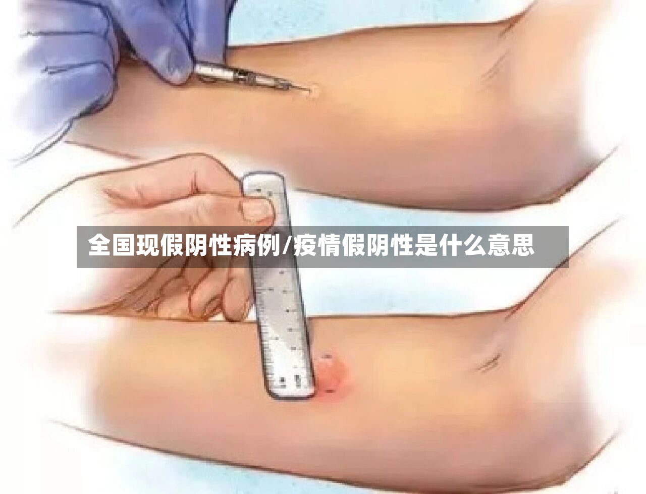 全国现假阴性病例/疫情假阴性是什么意思