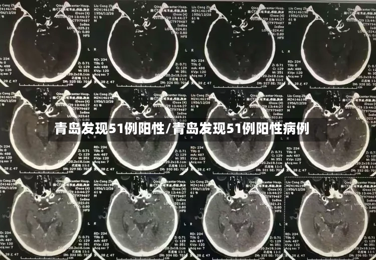青岛发现51例阳性/青岛发现51例阳性病例-第2张图片