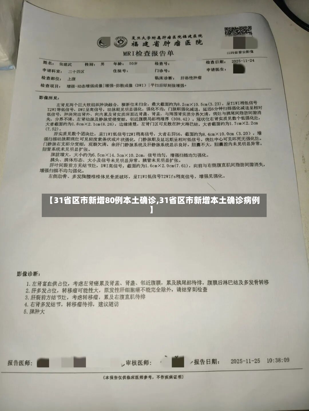 【31省区市新增80例本土确诊,31省区市新增本土确诊病例】-第3张图片