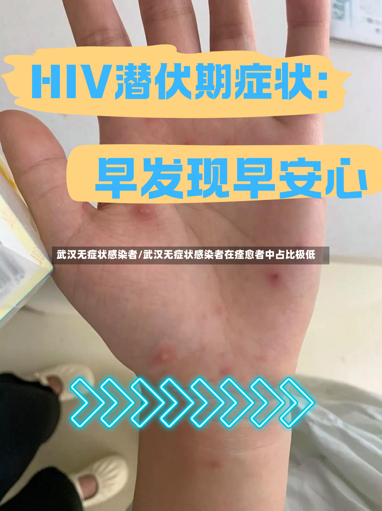 武汉无症状感染者/武汉无症状感染者在痊愈者中占比极低-第2张图片