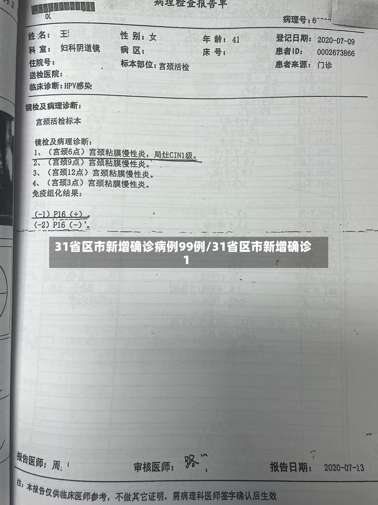 31省区市新增确诊病例99例/31省区市新增确诊1-第2张图片