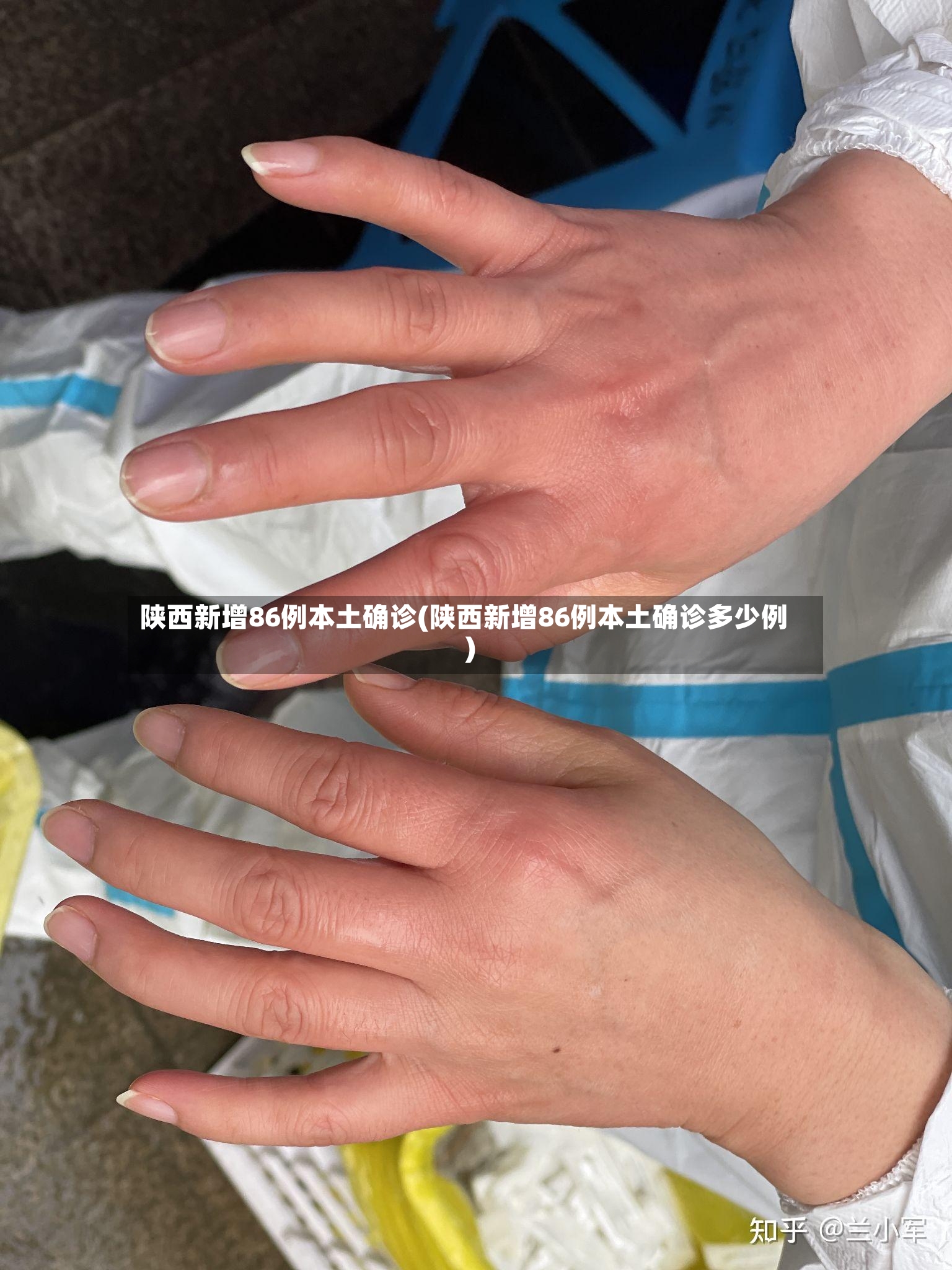 陕西新增86例本土确诊(陕西新增86例本土确诊多少例)