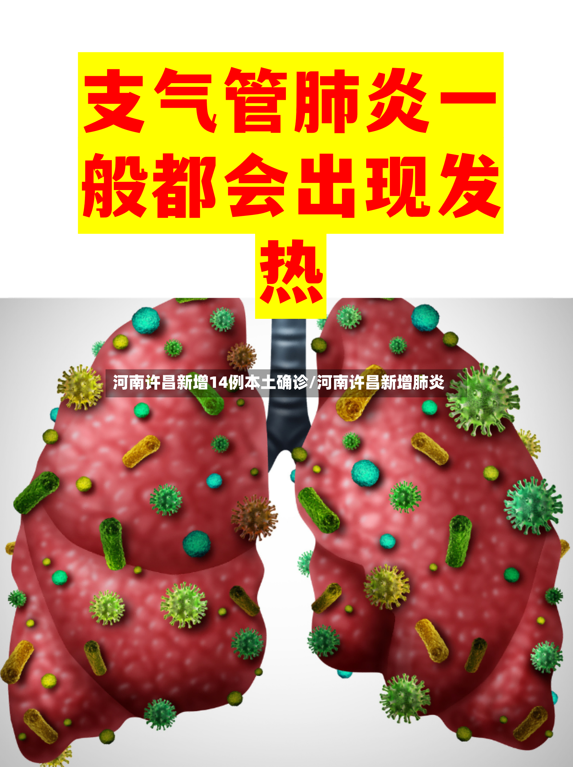 河南许昌新增14例本土确诊/河南许昌新增肺炎-第3张图片