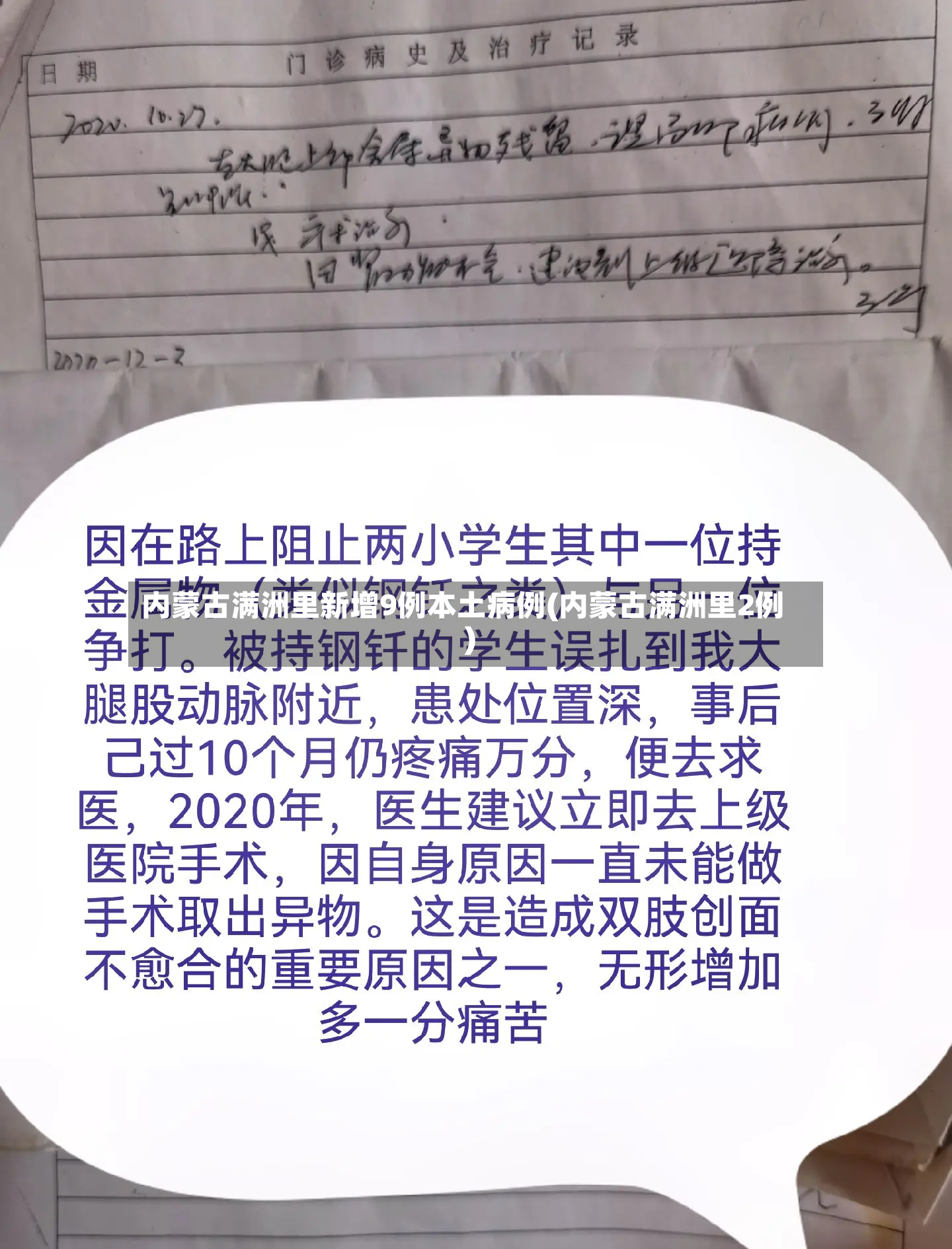 内蒙古满洲里新增9例本土病例(内蒙古满洲里2例)