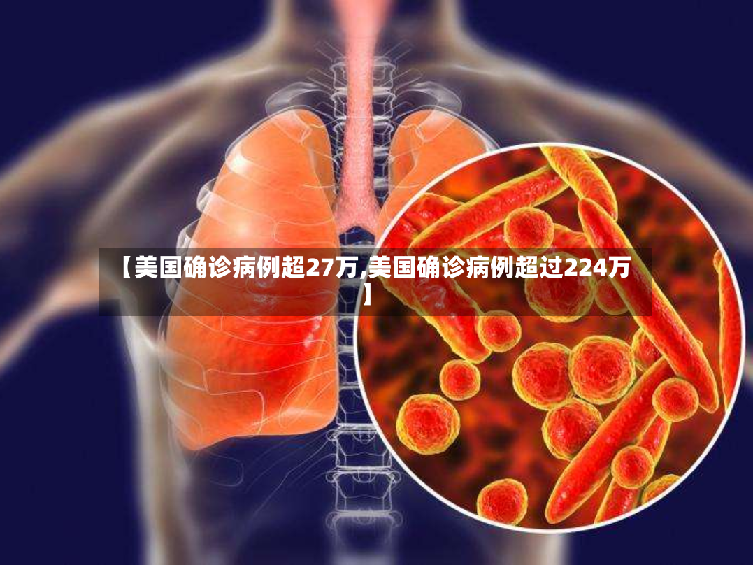 【美国确诊病例超27万,美国确诊病例超过224万】