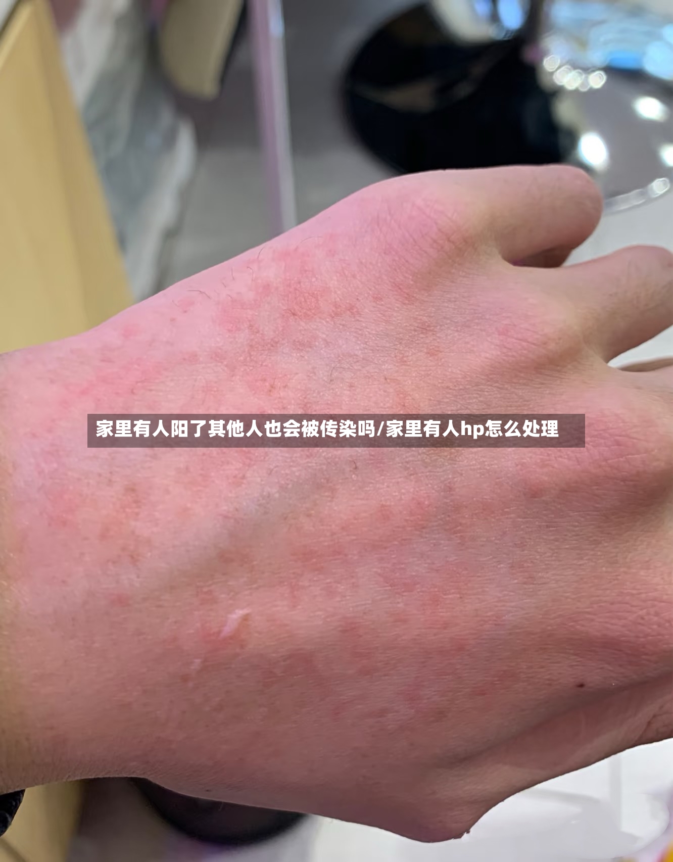 家里有人阳了其他人也会被传染吗/家里有人hp怎么处理