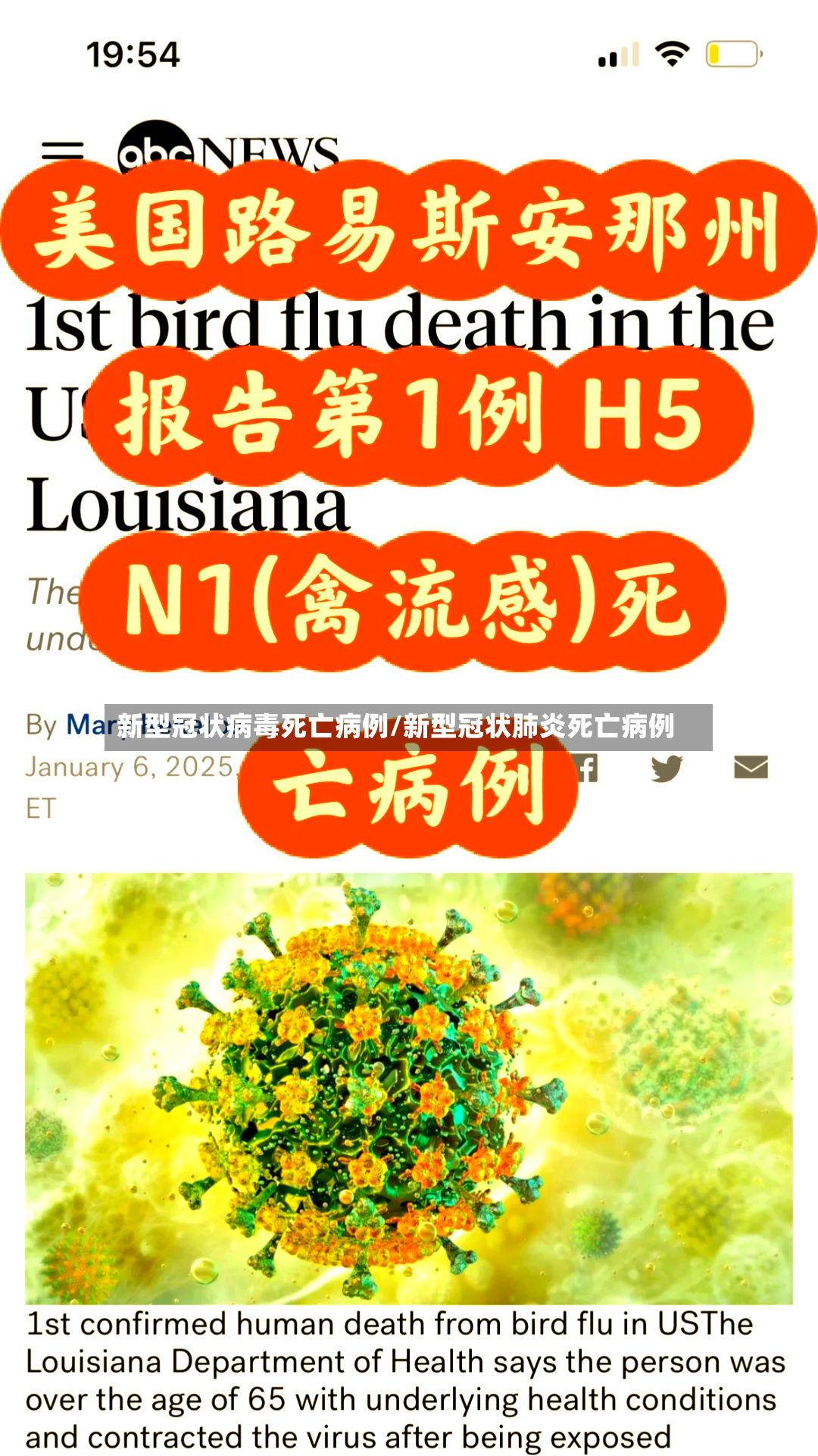 新型冠状病毒死亡病例/新型冠状肺炎死亡病例