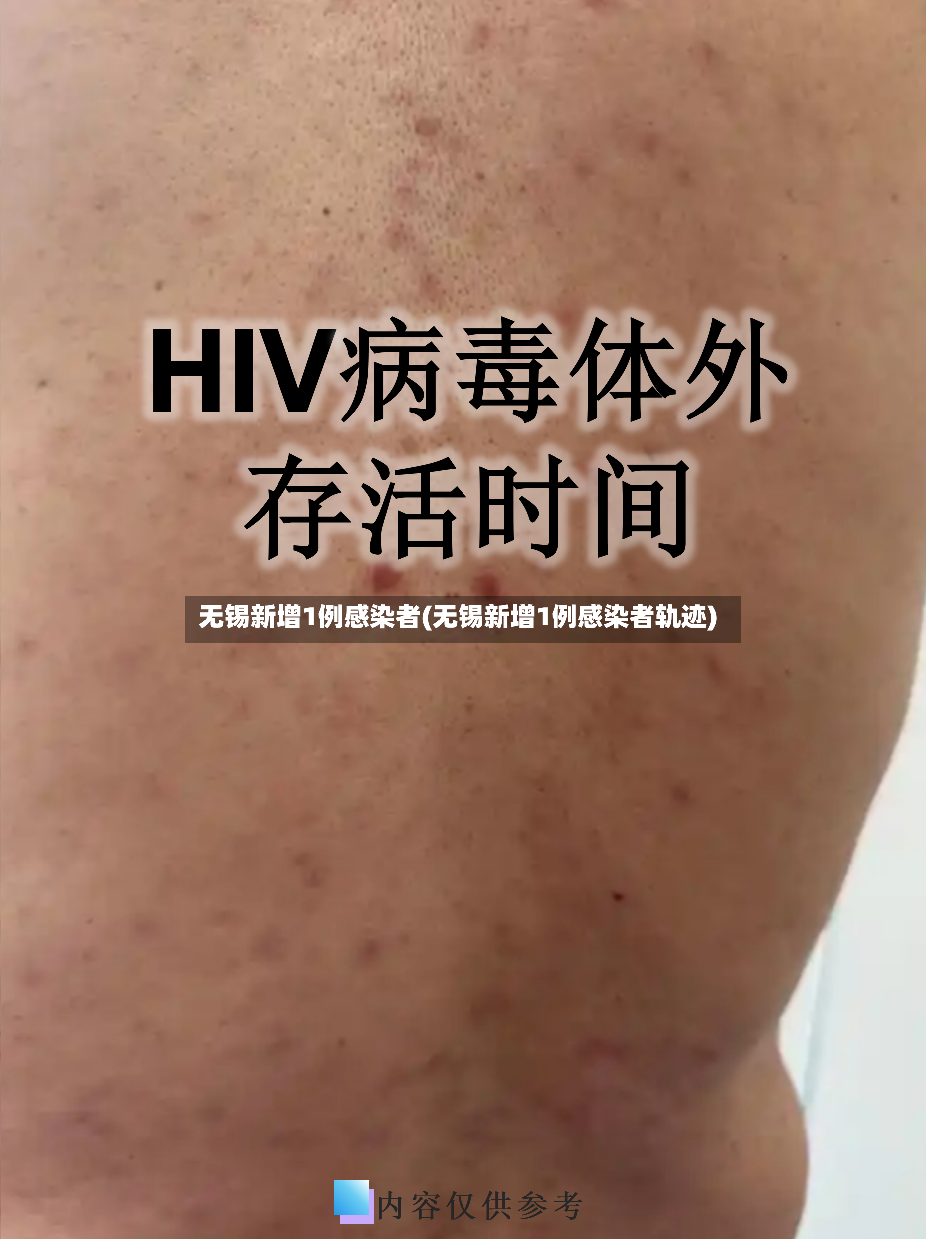 无锡新增1例感染者(无锡新增1例感染者轨迹)